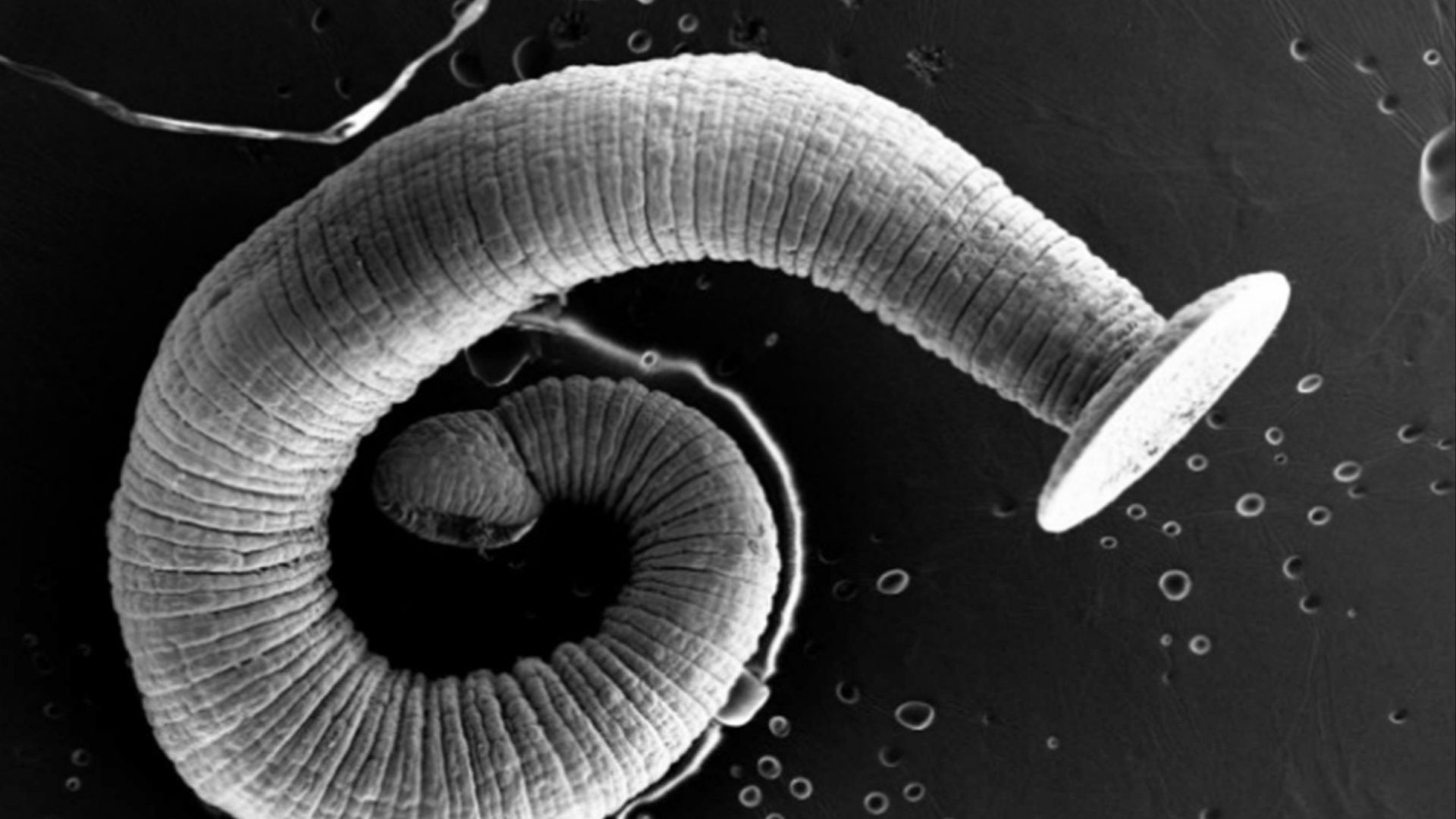 File:Tapeworm SEM2.jpg