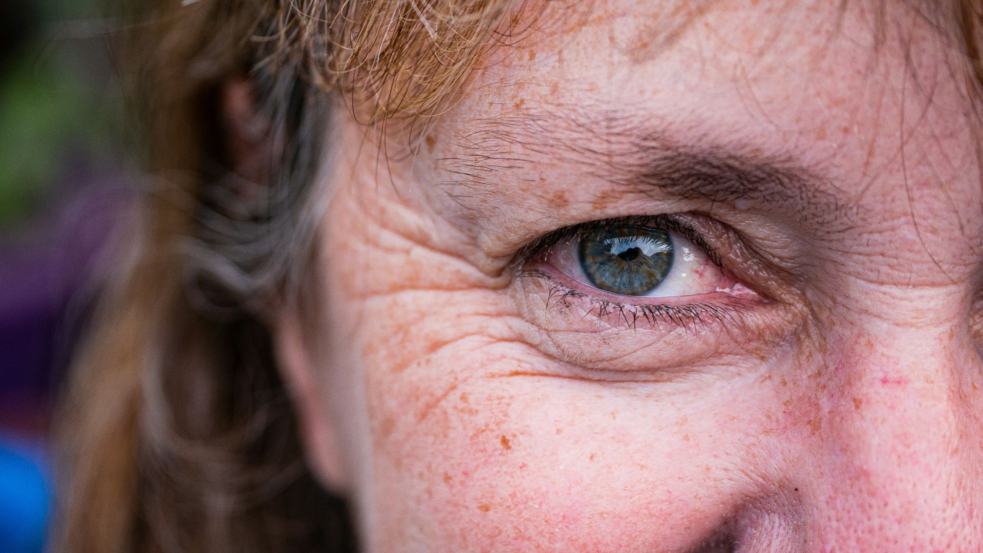 a close up of a person with freckled hair