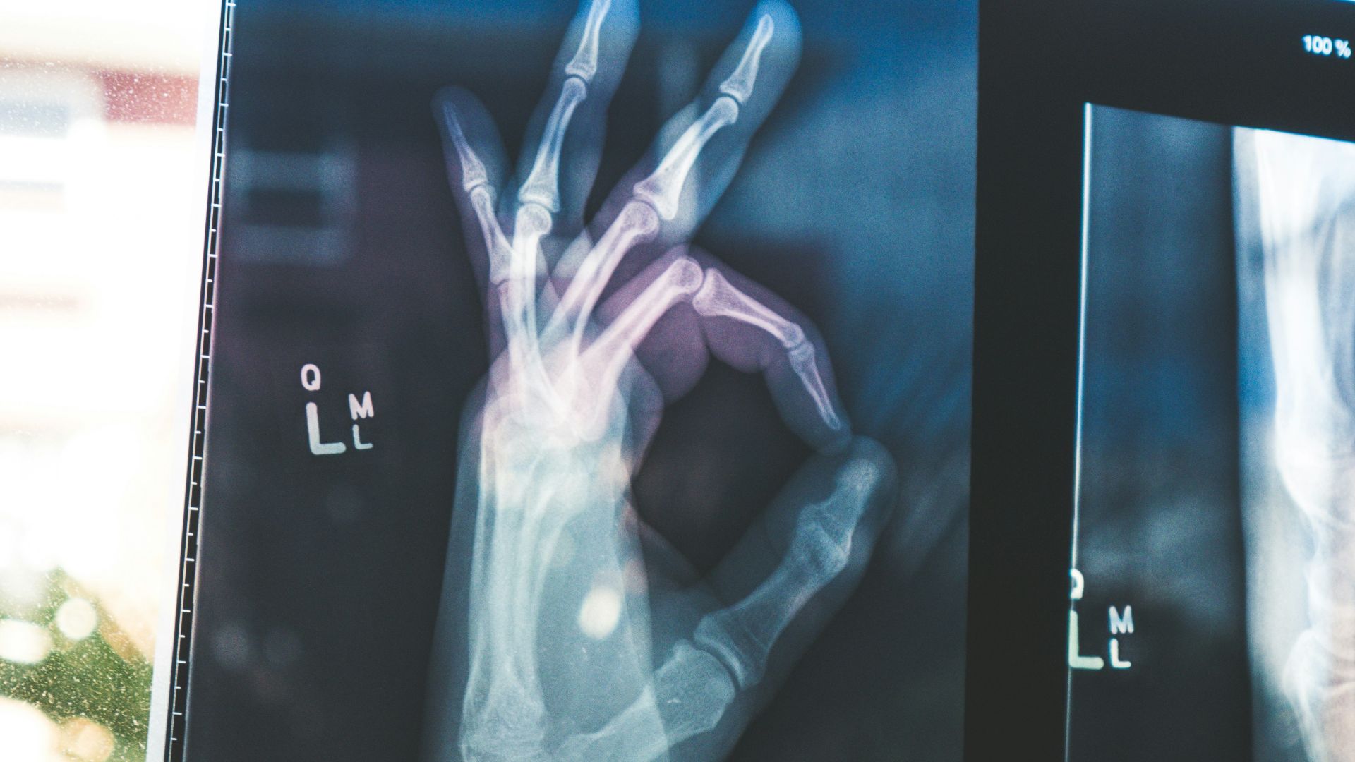 citiscan result hand ok