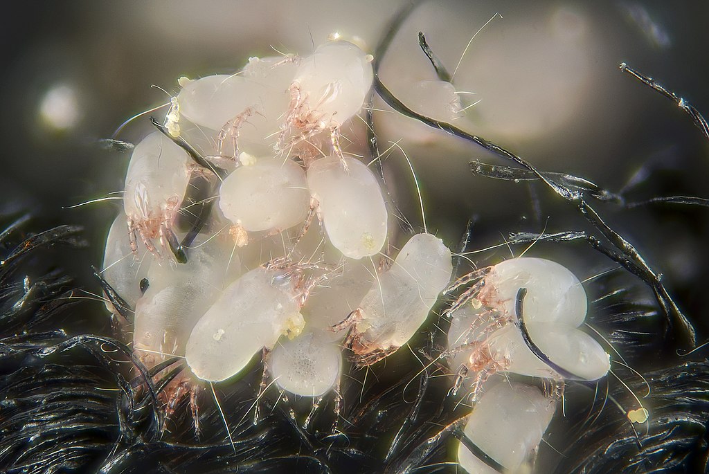 1024Px-House Dust Mites (5247397771)