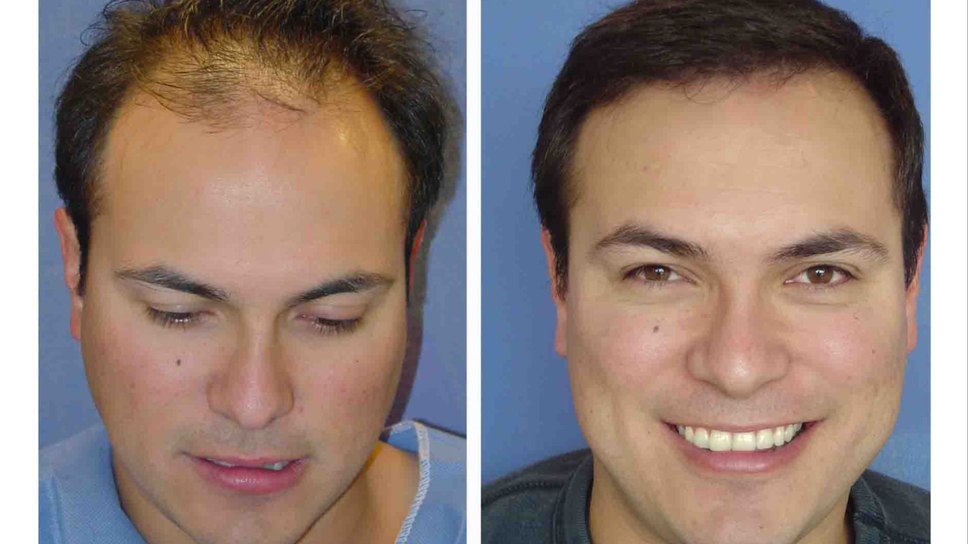 File:Microtranspel 1.jpg