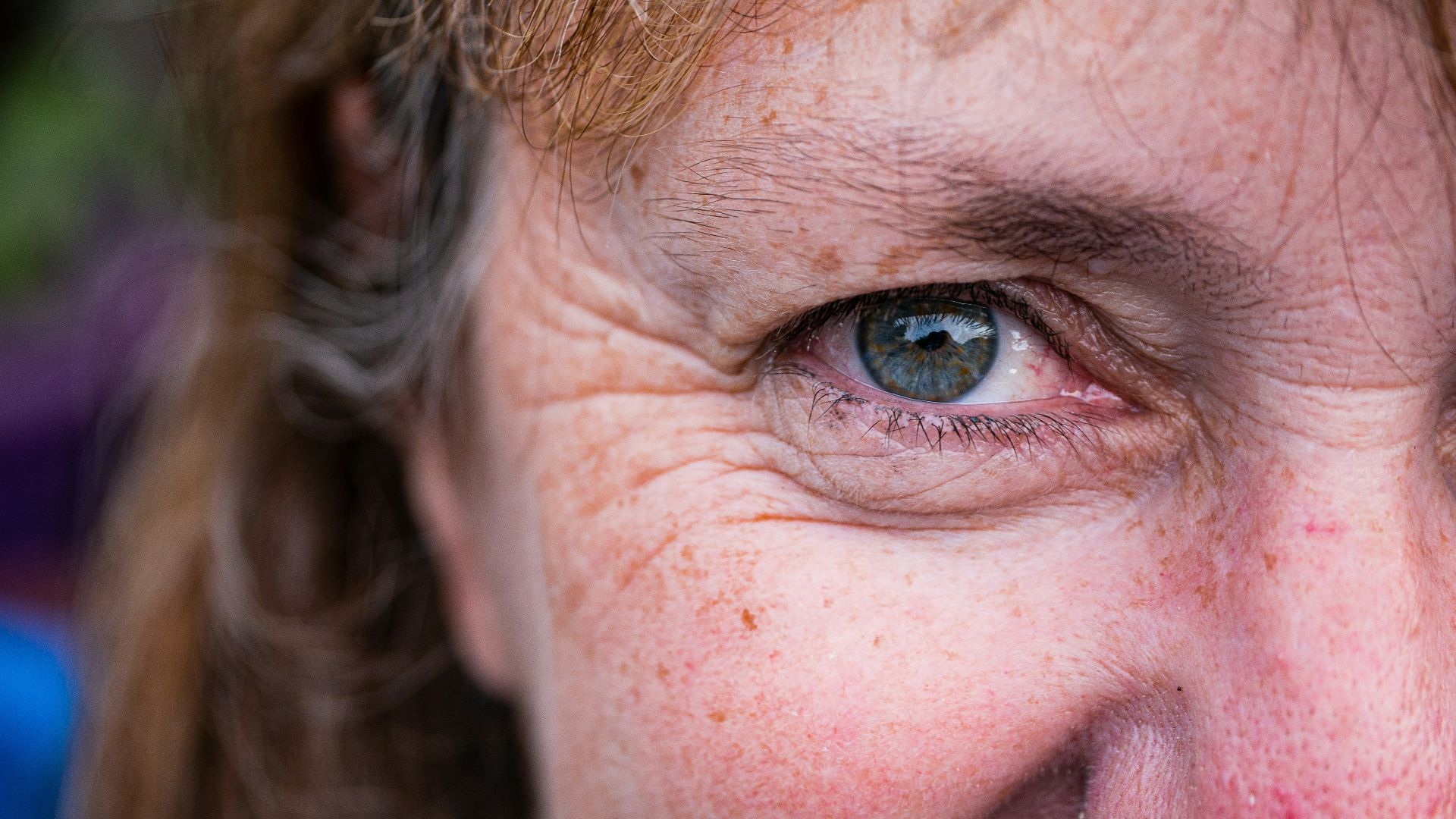 a close up of a person with freckled hair