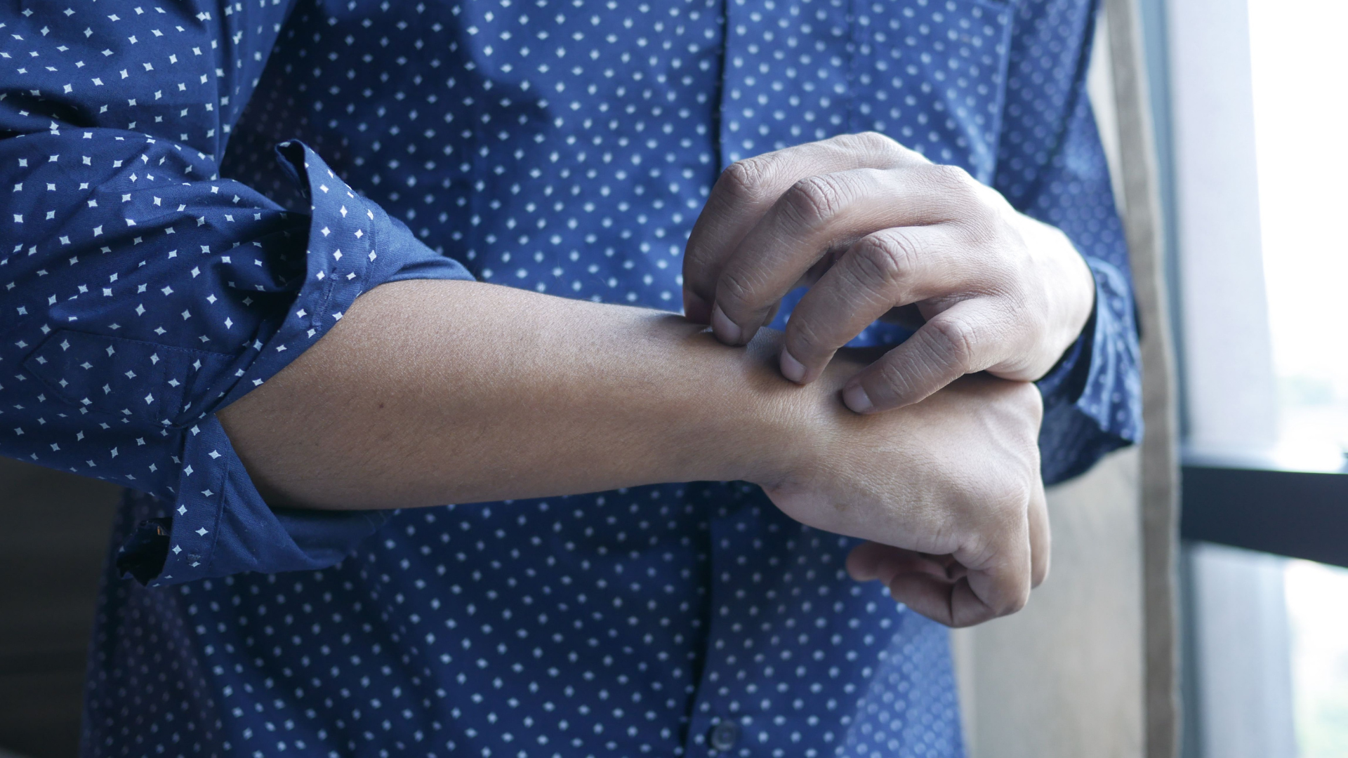 man-scratching-skin-thumb-rss.png