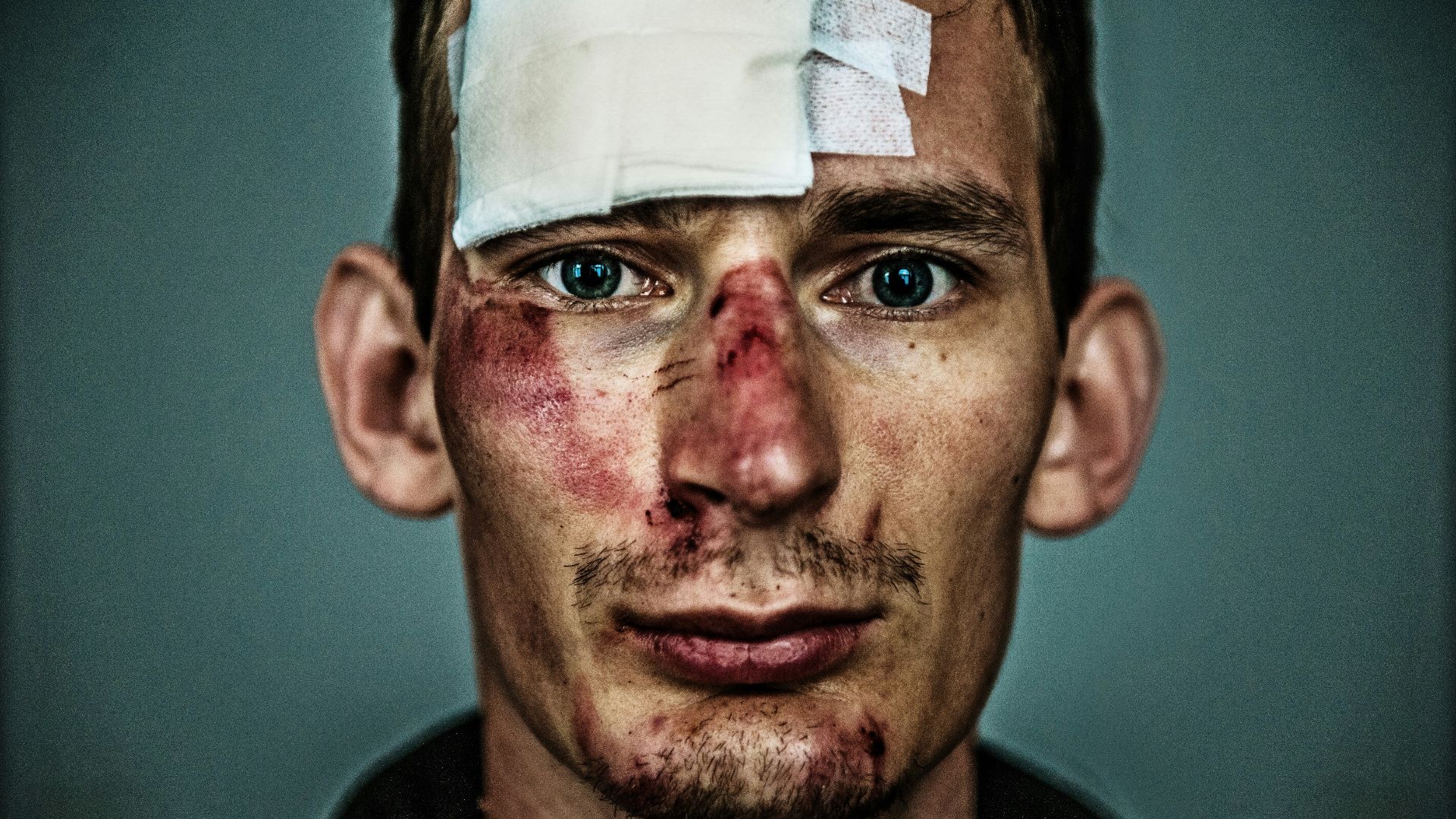 a man with a bandaged eye and a piece of paper on his forehead